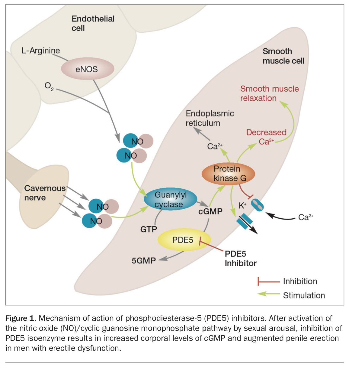 Erectile dysfunction. Part 2 Management of ED unresponsive to